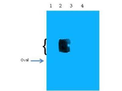 Western Blot: beta Amyloid [Pyro Glu11] Antibody [NBP1-44070]